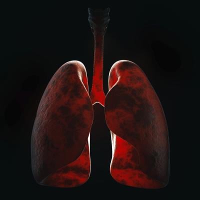 TB is an infectious disease of the lungs that kills more than a million people worldwide every year. 