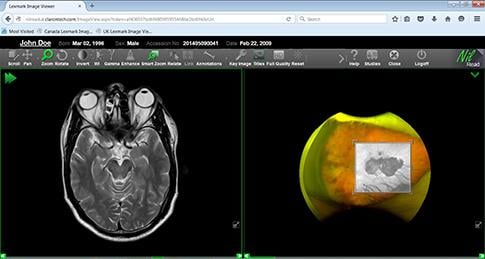 Hyland Healthcare Adds ImageNext Imaging Workflow Optimizer to Enterprise Imaging Suite