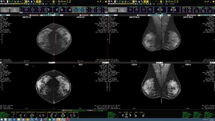 Konica Minolta Highlights New Exa Mammo Features at SBI/ACR Breast Imaging Symposium