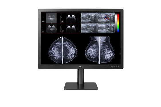 #LG Business Solutions USA has announced the latest in LG’s full line of professional, medical-grade #diagnostic #monitors, the 31-inch, 12-megapixel #31HN713D, which can be used for multiple modes of #diagnostic study, including 3-D #mammography.