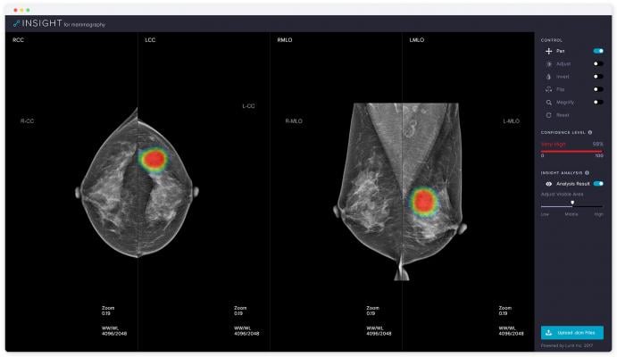 Lunit Unveiling AI-Based Mammography Solution at RSNA 2018