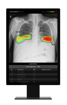 Lunit's AI-powered chest X-ray analysis solution 'Lunit INSIGHT CXR'
