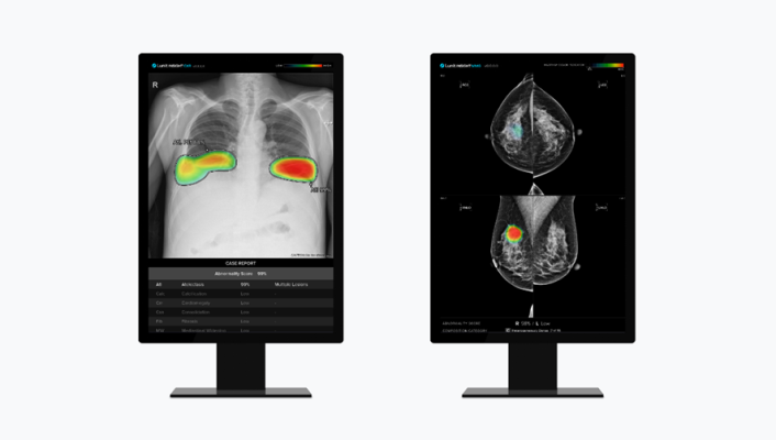 Two oral presentations and five ePosters accepted by the RSNA: presenting AI advancements for chest radiograph reporting efficiency and breast cancer risk assessment 