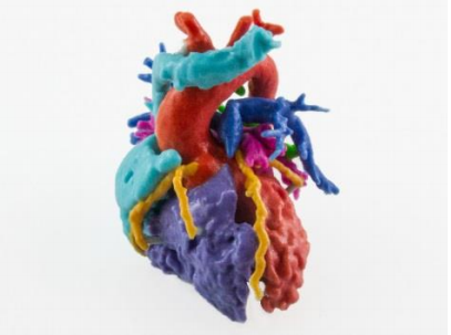 Multicolor model of a congenital heart defect.
