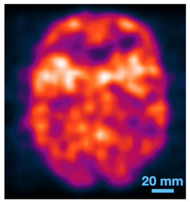 New ultrafast photon detectors allow for rapid processing of data from positron emission or X-ray scans without the need for tomography to reconstruct images. This image shows a brain phantom (model) scanned by positron emission using the new technology. 