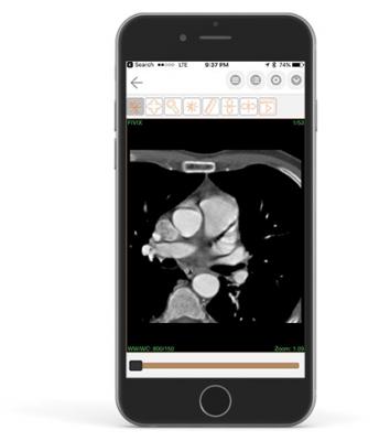 Paxeramed Demonstrates Patient-Centric Image Sharing Platform at RSNA 2017