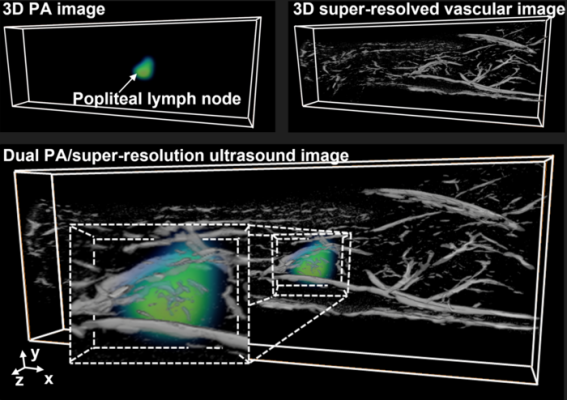 Researchers at the University of Illinois Urbana Champaign have developed a dual-modality imaging technique that not only delivers comprehensive diagnostic information but also provides a cost-effective solution for healthcare providers 