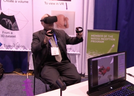 ITN Editor Dave Fornell tries his hand at virtual reality at RSNA 2017. He was named a 2018 Neal Award finalist for best range of work by a single author.