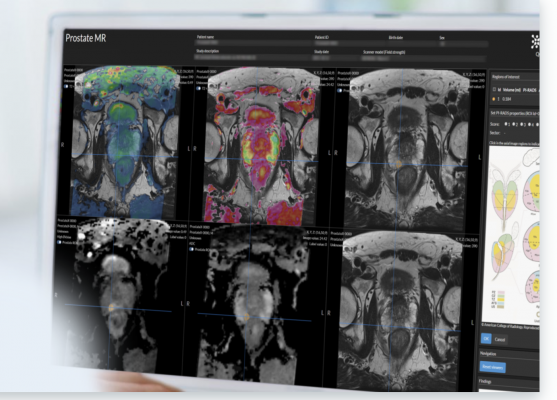 The FDA clearance, Quantib’s 6th to date, marks the first time a comprehensive AI prostate solution will be available to radiologists in the United States