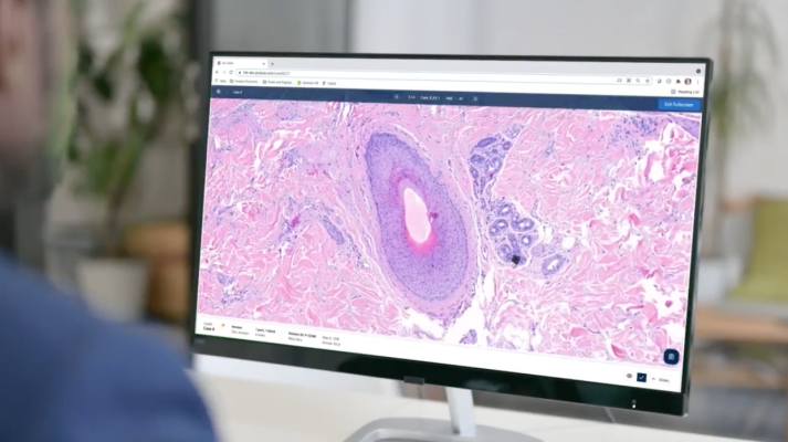 Proscia, a leader in digital and computational pathology solutions, announced a multi-year OEM agreement with Siemens Healthineers. Under the agreement, Siemens Healthineers will expand its Enterprise Imaging offering towards the global digital pathology market using Proscia’s Concentriq Dx platform.