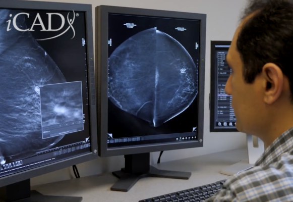 Company’s ROI Tool offers preview of business value the ProFound Breast AI Suite offers to clinicians and imaging facilities