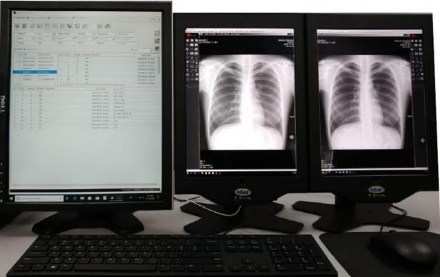 USEI Introduces Window-based iPad Medical Imaging Viewing Solution at RSNA 2018