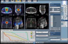 FDA Clears MRI-Guided Radiation Therapy System