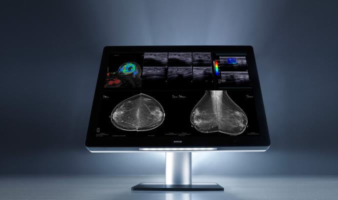 Barco, patent, I-Luminate technology, breast imaging, Just Noticeable Differences, mammography