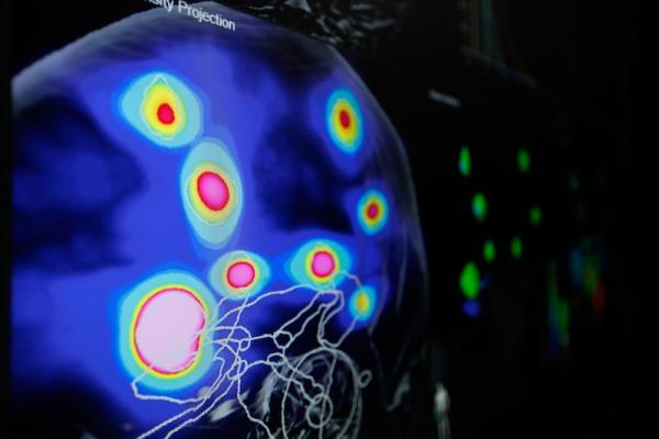 Brainlab Introduces New Concept for Treatment of Multiple Brain Metastases