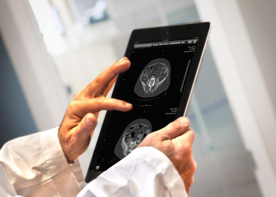 Calgary Scientific, Mass General Hospital, RadIQ, mobile radiology education tool, RSNA 2015