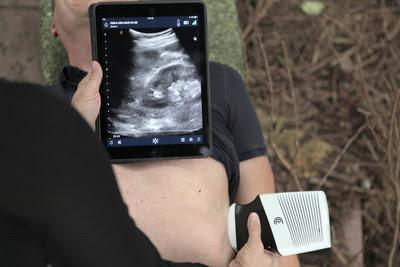 Clarius Demonstrates Point-of-Care Ultrasound for Disaster and Emergency Medicine