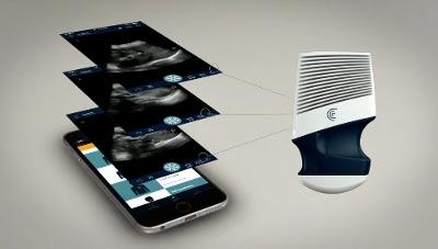 Clarius Mobile Health, C3, L7, wireless ultrasound scanners, FDA 510k clearance