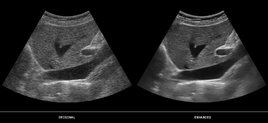 ContextVision, RSNA 2015, ultrasound image enhancement, 3-D/4-D