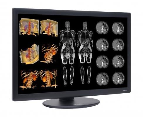 NDS Surgical Imaging Dome S6c Diagnostic Flat Panel Display RSNA 2014