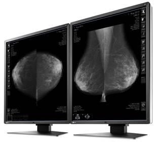 Eizo, RadiForce GX550 medical monitor, FDA approval, digital breast tomosynthesis, DBT, mammography, RSNA 2016