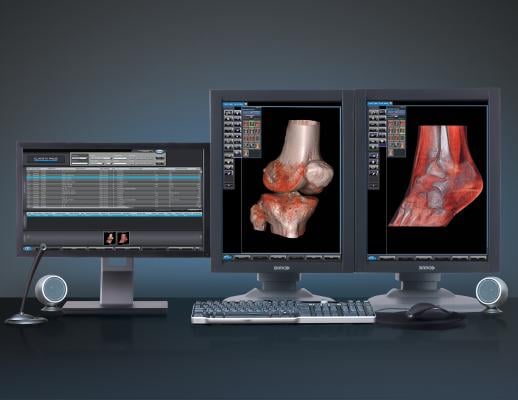 Fovia and iCRco Deliver High Definition Volume Rendering to the Orthopedic Market