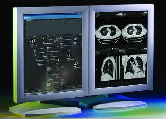 HealthMyne, QIDS, Quantitative Imaging Decision Support software, CDS, clinical decision support, RSNA 2016