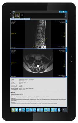 Image Information Systems, Med-Tab, first portable DICOM calibrated tablet, medical image display, RSNA 2015