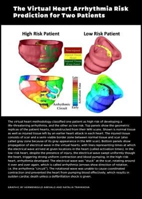 Johns Hopkins, virtual heart modeling tool, VARP, arrhythmias, implanted defibrillator