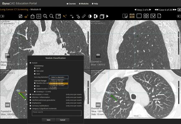Philips, low-dose CT, lung cancer screening, FDA approval