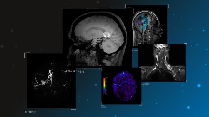 neurological disorders, MRI