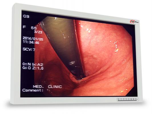 AlphaView Introduces 24-inch Surgical Display