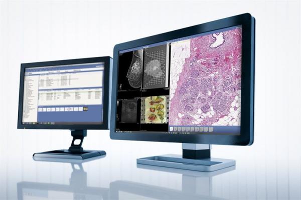 Sectra, RSNA 2015, digital pathology, radiology, integrated solutions, cancer care