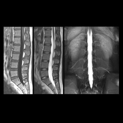 spinal cord, learning, fMRI, University of Montreal