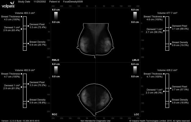 Volpara, Density Maps, breast density measurement, FDA clearance