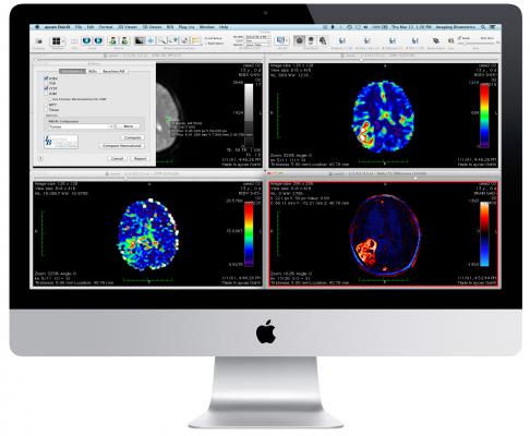 aycan OsiriX PRO PACS Oncology information management system (OIMS) RSNA 2014