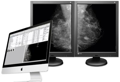 aycan, Mammography Workstation, Eizo monitors