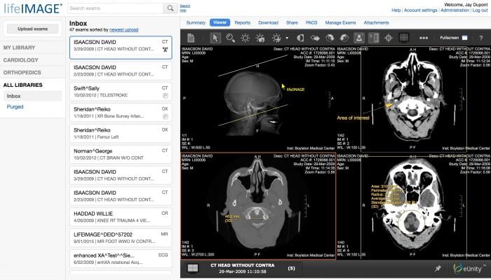 lifeIMAGE, version 5.0, medical image viewing platform, RSNA 2016, eUnity Collaboration