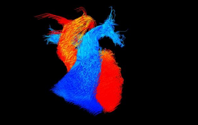 BHF, Reflections of Research image competition, U.K., 4-D MRI, heart blood flow