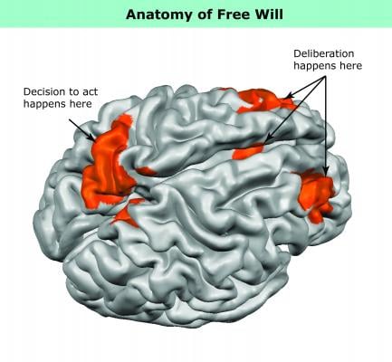 MRI, brain activity