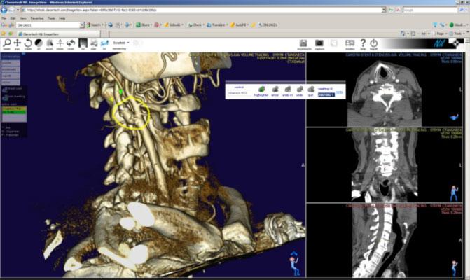 Nil 4.0, PACS 3.0, Claron Technology, remote viewing systems, RSNA 2014
