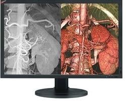 Quest Introduces Its Next Generation AlphaView 4 MP Medical LCD