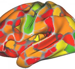 Brain Scans May Help Diagnose Neurological, Psychiatric Disorders