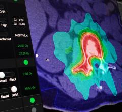 BrainLAB Announces FDA Clearance For Two New Indication-Specific Radiosurgery Software Applications
