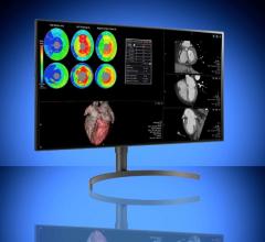 Double Black Imaging (DBI) announced the immediate availability of two radiology-focused medical-grade displays from LG Electronics bundled with DBI’s comprehensive calibration software package.