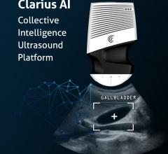 Clarius Mobile Health Announces Clarius AI Collective Intelligence Ultrasound Platform