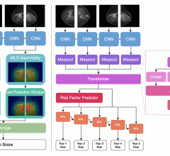 Researchers have developed a new, interpretable artificial intelligence (AI) model to predict 5-year breast cancer risk from mammograms, according to a new study published today in Radiology