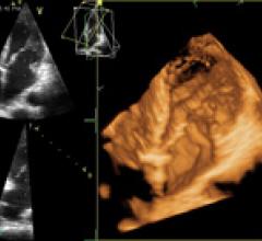 ASE Study Shows Echocardiography Benefits for Cancer Patients 