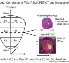 prostate cancer, biopsy, PET-CT, Ga-68 PSMA, SNMMI 2016 study, Wolfgang Fendler