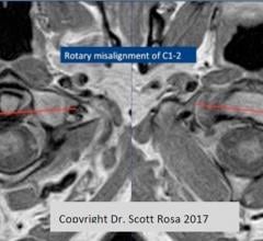 Book Chapter Reports on Fonar Upright MRI for Hydrocephalus Imaging
